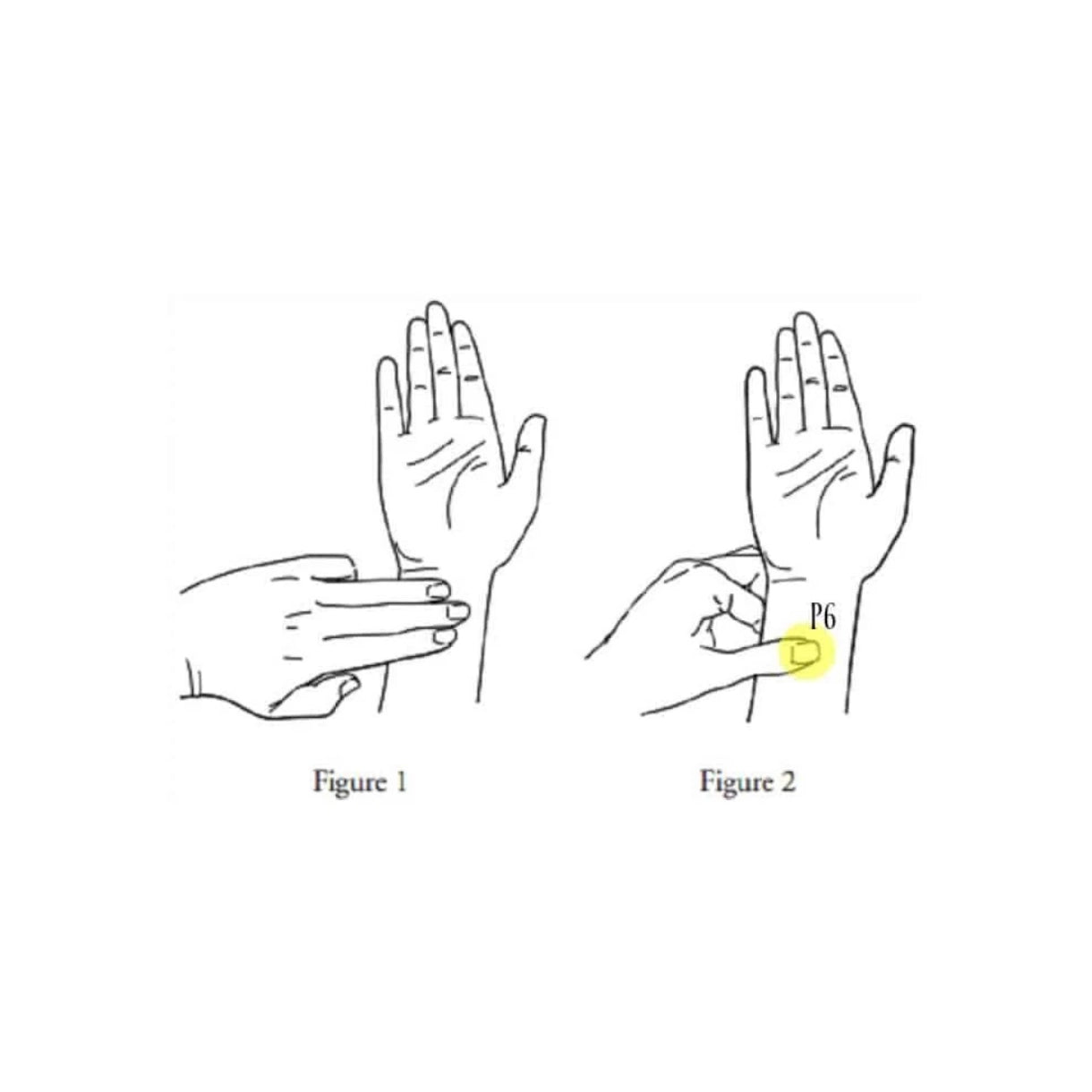 Nausea Relief Acupressure Bands